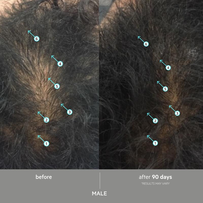 Male · before / after 90 days