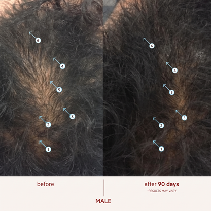 Anti-Gray Hair Density Serum